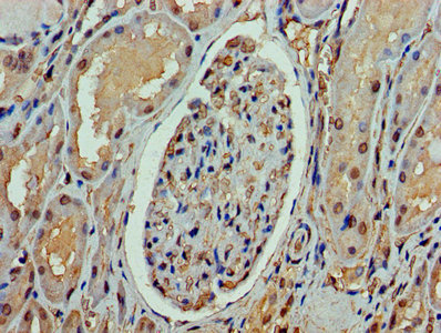 Immunohistochemistry of paraffin-embedded human kidney tissue using ASH2L Antibody at dilution of 1:100Rabbit anti-Human ASH2L Polyclonal Antibody