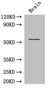 Western Blot | Positive WB detected in: Mouse brain tissue | All lanes: ASH2L antibody at 3μg/ml | Secondary | Goat polyclonal to rabbit IgG at 1/50000 dilution | Predicted band size: 69, 57, 61 kDa | Observed band size: 69 kDaRabbit anti-Human ASH2L Polyclonal Antibody