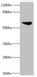 Western blot | All lanes: Set1/Ash2 histone methyltransferase complex subunit ASH2 antibody at 2μg/ml + K562 whole cell lysate | Secondary | Goat polyclonal to rabbit IgG at 1/10000 dilution | Predicted band size: 69, 57, 61 kDa | Observed band size: 69 kDaRabbit anti-Human ASH2L Polyclonal Antibody