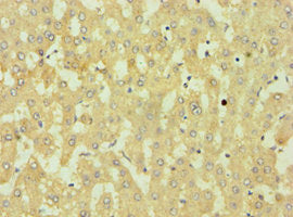 Immunohistochemistry of paraffin-embedded human liver tissue using DKK4 Antibody at dilution of 1:100Rabbit anti-Human DKK4 Polyclonal Antibody