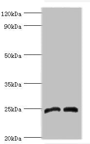Western blot | All lanes: Dickkopf-related protein 4 antibody at 8μg/ml | Lane 1: Jurkat whole cell lysate | Lane 2: K562 whole cell lysate | Secondary | Goat polyclonal to rabbit IgG at 1/10000 dilution | Predicted band size: 25 kDa | Observed band size: 25 kDaRabbit anti-Human DKK4 Polyclonal Antibody
