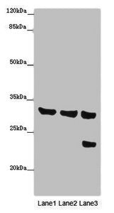 Western blot  | All lanes: SLC25A10 antibody at 16µg/ml  | Lane 1: Mouse liver tissue  | Lane 2: Mouse kidney tissue  | Lane 3: HepG2 whole cell lysate  | Secondary  | Goat polyclonal to rabbit IgG at 1/10000 dilution  | Predicted band size: 32, 33 kDa  | Observed band size: 32, 24 kDaRabbit anti-Human SLC25A10 Polyclonal Antibody