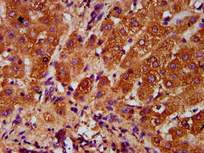 IHC image of AASS Antibody diluted at 1:400 and staining in paraffin-embedded human liver tissue performed on a Leica BondTM system. After dewaxing and hydration, antigen retrieval was mediated by high pressure in a citrate buffer (pH 6.0). Section was blocked with 10% normal goat serum 30min at RT. Then primary antibody (1% BSA) was incubated at 4°C overnight. The primary is detected by a biotinylated secondary antibody and visualized using an HRP conjugated SP system.