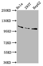 Western Blot  | Positive WB detected in: Hela whole cell lysate, 293T whole cell lysate, HepG2 whole cell lysate  | All lanes: AASS antibody at 5.8µg/ml  | Secondary  | Goat polyclonal to rabbit IgG at 1/50000 dilution  | Predicted band size: 103 kDa  | Observed band size: 103 kDa