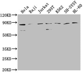 Western Blot | Positive WB detected in: Hela whole cell lysate, Raji whole cell lysate, Jurkat whole cell lysate, 293T whole cell lysate, K562 whole cell lysate, SH-SY5Y whole cell lysate, HL-60 whole cell lysate | All lanes: ZRANB1 antibody at 1:2000 | Secondary | Goat polyclonal to rabbit IgG at 1/50000 dilution | Predicted band size: 81 kDa | Observed band size: 81 kDaRabbit anti-Human ZRANB1 Polyclonal Antibody