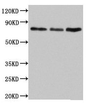 Western Blot  | Positive WB detected in: Jurkat whole cell lysate, Rat lung tissue, Mouse liver tissue  | All lanes: SUN2 antibody at 4.5µg/ml  | Secondary  | Goat polyclonal to rabbit IgG at 1/50000 dilution  | Predicted band size: 81, 83, 80 kDa  | Observed band size: 81 kDaRabbit anti-Human SUN2 Polyclonal Antibody