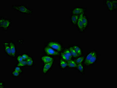 Immunofluorescent analysis of HepG2 cells using UBQLN2 Antibody at dilution of 1:100 and Alexa Fluor 488-congugated AffiniPure Goat Anti-Rabbit IgG(H+L)Rabbit anti-Human UBQLN2 Polyclonal Antibody