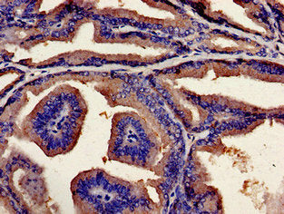 Immunohistochemistry analysis of human prostate tissue using the antibody at dilution of 1:100Rabbit anti-Human UBQLN2 Polyclonal Antibody