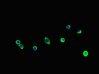 Immunofluorescent analysis of MCF-7 cells using PGAP2 Antibody at dilution of 1:100 and Alexa Fluor 488-congugated AffiniPure Goat Anti-Rabbit IgG(H+L)Rabbit anti-Human PGAP2 Polyclonal Antibody