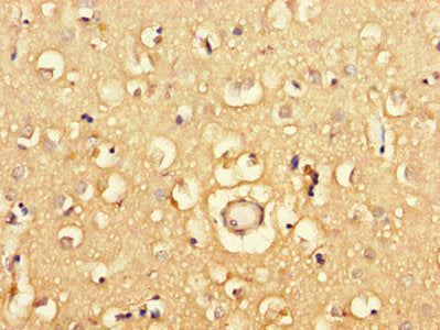 Immunohistochemistry of paraffin-embedded human brain tissue using the antibody at dilution of 1:100Rabbit anti-Human PGAP2 Polyclonal Antibody