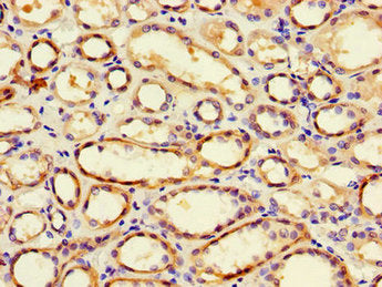 Immunohistochemistry of paraffin-embedded human kidney tissue using PGAP2 Antibody at dilution of 1:100Rabbit anti-Human PGAP2 Polyclonal Antibody