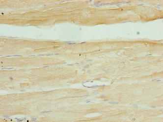 Immunohistochemistry of paraffin-embedded human skeletal muscle tissue using SERTAD1 Antibody at dilution of 1:100Rabbit anti-Human SERTAD1 Polyclonal Antibody