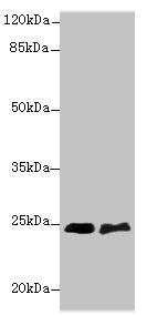 Western blot | All lanes: SERTAD1 antibody at 6μg/ml | Lane 1: SH-SY5Y whole cell lysate | Lane 2: A549 whole cell lysate | Secondary | Goat polyclonal to rabbit IgG at 1/10000 dilution | Predicted band size: 25 kDa | Observed band size: 25 kDaRabbit anti-Human SERTAD1 Polyclonal Antibody