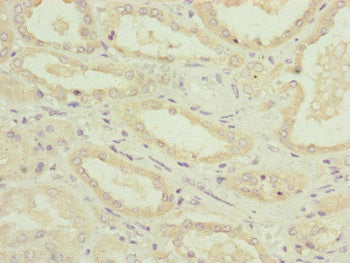 Immunohistochemistry of paraffin-embedded human kidney tissue using NDUFA12 Antibody at dilution of 1:100Rabbit anti-Human NDUFA12 Polyclonal Antibody