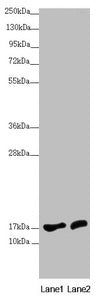 Western blot  | All lanes: NDUFA12 antibody at 3.71µg/ml  | Lane 1: HepG2 whole cell lysate  | Lane 2: 293T whole cell lysate  | Secondary  | Goat polyclonal to rabbit IgG at 1/10000 dilution  | Predicted band size: 18, 8 kDa  | Observed band size: 18 kDaRabbit anti-Human NDUFA12 Polyclonal Antibody