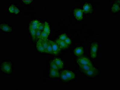 Immunofluorescence staining of HepG2 cells with DMGDH Antibody at 1:100, counter-stained with DAPI. The cells were fixed in 4% formaldehyde, permeabilized using 0.2% Triton X-100 and blocked in 10% normal Goat Serum. The cells were then incubated with the antibody overnight at 4°C. The secondary antibody was Alexa Fluor 488-congugated AffiniPure Goat Anti-Rabbit IgG(H+L).Rabbit anti-Human DMGDH Polyclonal Antibody