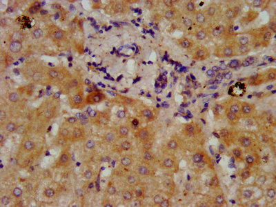 IHC image of DMGDH Antibody diluted at 1:300 and staining in paraffin-embedded human liver tissue performed on a Leica BondTM system. After dewaxing and hydration, antigen retrieval was mediated by high pressure in a citrate buffer (pH 6.0). Section was blocked with 10% normal goat serum 30min at RT. Then primary antibody (1% BSA) was incubated at 4°C overnight. The primary is detected by a biotinylated secondary antibody and visualized using an HRP conjugated SP system.Rabbit anti-Human DMGDH Polyclonal Antibody