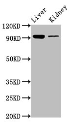 Western Blot | Positive WB detected in: Mouse liver tissue, Mouse kidney tissue | All lanes: DMGDH antibody at 6.7μg/ml | Secondary | Goat polyclonal to rabbit IgG at 1/50000 dilution | Predicted band size: 97, 46 kDa | Observed band size: 97 kDaRabbit anti-Human DMGDH Polyclonal Antibody