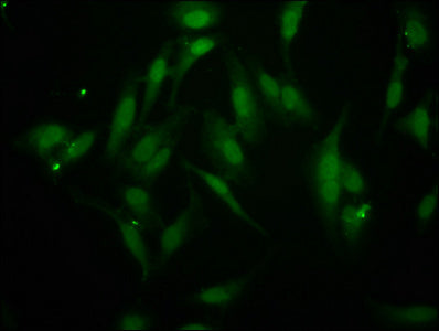 Immunofluorescence staining of Hela cells with BAZ2B Antibody at 1:266, counter-stained with DAPI. The cells were fixed in 4% formaldehyde, permeabilized using 0.2% Triton X-100 and blocked in 10% normal Goat Serum. The cells were then incubated with the antibody overnight at 4°C. The secondary antibody was Alexa Fluor 488-congugated AffiniPure Goat Anti-Rabbit IgG(H+L).