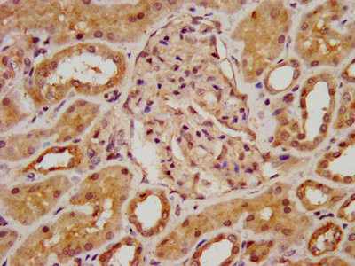 IHC image of BAZ2B Antibody diluted at 1:800 and staining in paraffin-embedded human kidney tissue performed on a Leica BondTM system. After dewaxing and hydration, antigen retrieval was mediated by high pressure in a citrate buffer (pH 6.0). Section was blocked with 10% normal goat serum 30min at RT. Then primary antibody (1% BSA) was incubated at 4°C overnight. The primary is detected by a biotinylated secondary antibody and visualized using an HRP conjugated SP system.