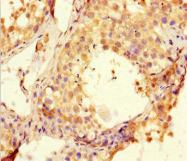 Immunohistochemistry of paraffin-embedded human testis tissue using BTNL2 Antibody at dilution of 1:100
