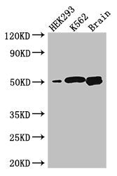 Western Blot  | Positive WB detected in: HEK293 whole cell lysate, K562 whole cell lysate, Mouse brain tissue  | All lanes: BTNL2 antibody at 3.2µg/ml  | Secondary  | Goat polyclonal to rabbit IgG at 1/50000 dilution  | Predicted band size: 51, 44, 31, 28, 20, 29 kDa  | Observed band size: 51 kDa