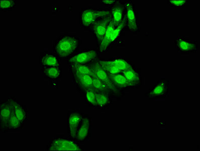 Immunofluorescence staining of HepG2 cells with PYGO2 Antibody at 1:100, counter-stained with DAPI. The cells were fixed in 4% formaldehyde, permeabilized using 0.2% Triton X-100 and blocked in 10% normal Goat Serum. The cells were then incubated with the antibody overnight at 4°C. The secondary antibody was Alexa Fluor 488-congugated AffiniPure Goat Anti-Rabbit IgG(H+L).Rabbit anti-Human PYGO2 Polyclonal Antibody
