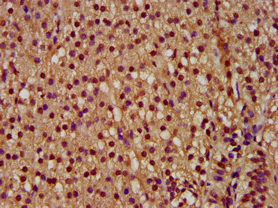 IHC image of PYGO2 Antibody diluted at 1:300 and staining in paraffin-embedded human adrenal gland tissue performed on a Leica BondTM system. After dewaxing and hydration, antigen retrieval was mediated by high pressure in a citrate buffer (pH 6.0). Section was blocked with 10% normal goat serum 30min at RT. Then primary antibody (1% BSA) was incubated at 4°C overnight. The primary is detected by a biotinylated secondary antibody and visualized using an HRP conjugated SP system.Rabbit anti-Human PYGO2 Polyclonal Antibody