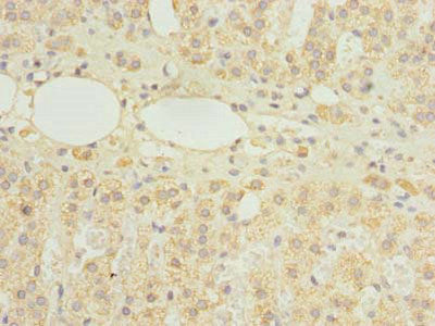 Immunohistochemistry of paraffin-embedded human adrenal gland tissue using HDHD3 Antibody at dilution of 1:100Rabbit anti-Human HDHD3 Polyclonal Antibody