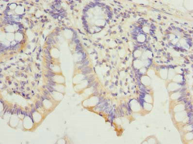 Immunohistochemistry of paraffin-embedded human small intestine tissue using HDHD3 Antibody at dilution of 1:100Rabbit anti-Human HDHD3 Polyclonal Antibody