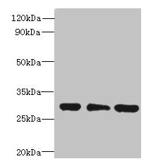 Western blot | All lanes: HDHD3 antibody at 1μg/ml | Lane 1: Mouse small intestine tissue | Lane 2: HT29 whole cell lysate | Lane 3: COLO205 whole cell lysate | Secondary | Goat polyclonal to rabbit IgG at 1/10000 dilution | Predicted band size: 28 kDa | Observed band size: 28 kDaRabbit anti-Human HDHD3 Polyclonal Antibody