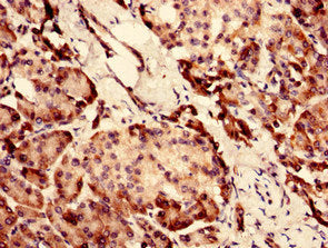 Immunohistochemistry analysis of human pancreatic tissue using CHID1 Antibody at dilution of 1:100Rabbit anti-Human CHID1 Polyclonal Antibody