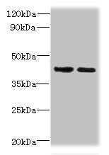 Western blot | All lanes: CHID1 antibody at 0.2μg/ml | Lane 1: Hela whole cell lysate | Lane 2: U251 whole cell lysate | Secondary | Goat polyclonal to rabbit IgG at 1/10000 dilution | Predicted band size: 45, 48, 42 kDa | Observed band size: 45 kDaRabbit anti-Human CHID1 Polyclonal Antibody