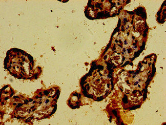 Immunohistochemistry of paraffin-embedded human placenta tissue using CARD14 Antibody at dilution of 1:100