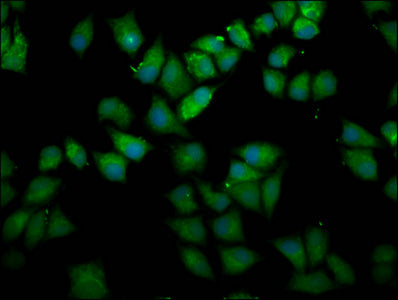 Immunofluorescence staining of Hela cells with UPF3B Antibody at 1:166, counter-stained with DAPI. The cells were fixed in 4% formaldehyde, permeabilized using 0.2% Triton X-100 and blocked in 10% normal Goat Serum. The cells were then incubated with the antibody overnight at 4°C. The secondary antibody was Alexa Fluor 488-congugated AffiniPure Goat Anti-Rabbit IgG(H+L).Rabbit anti-Human UPF3B Polyclonal Antibody