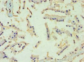 Immunohistochemistry of paraffin-embedded human prostate tissue using TBL1XR1 Antibody at dilution of 1:100Rabbit anti-Human TBL1XR1 Polyclonal Antibody