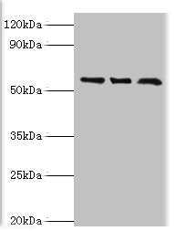 Western blot | All lanes: F-box-like/WD repeat-containing protein TBL1XR1 antibody at 10μg/ml | Lane 1: MCF-7 whole cell lysate | Lane 2: Mouse heart tissue | Lane 3: K562 whole cell lysate | Secondary | Goat polyclonal to rabbit IgG at 1/10000 dilution | Predicted band size: 56 kDa | Observed band size: 56 kDaRabbit anti-Human TBL1XR1 Polyclonal Antibody