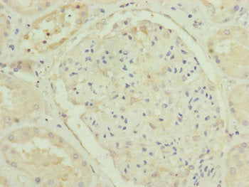 Immunohistochemistry of paraffin-embedded human kidney tissue using TRIM31 Antibody at dilution of 1:100Rabbit anti-Human TRIM31 Polyclonal Antibody