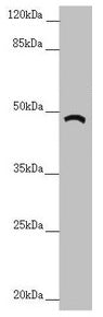 Western blot  | All lanes: TRIM31 antibody at 6.18µg/ml + A549 whole cell lysate  | Secondary  | Goat polyclonal to rabbit IgG at 1/10000 dilution  | Predicted band size: 49, 31 kDa  | Observed band size: 49 kDaRabbit anti-Human TRIM31 Polyclonal Antibody