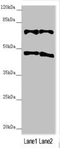 Western blot | All lanes: TRIM31 antibody at 4.98 μg/ml | Lane 1: HepG2 whole cell lysate | Lane 2: Hela whole cell lysate | Secondary | Goat polyclonal to rabbit IgG at 1/10000 dilution | Predicted band size: 49, 31 kDa | Observed band size: 49, 70 kDaRabbit anti-Human TRIM31 Polyclonal Antibody