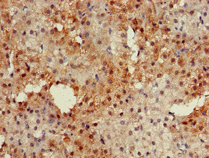 Immunohistochemistry of paraffin-embedded human adrenal gland tissue using the antibody at dilution of 1:100Rabbit anti-Human PKIB Polyclonal Antibody