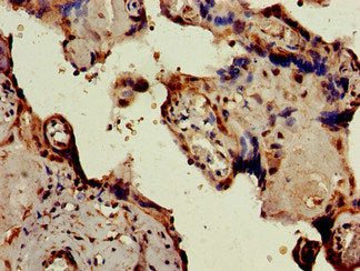 Immunohistochemistry of paraffin-embedded human placenta tissue using PKIB Antibody at dilution of 1:100Rabbit anti-Human PKIB Polyclonal Antibody
