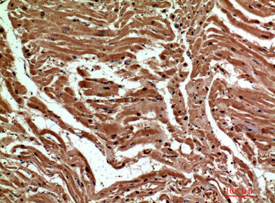 Immunohistochemical analysis of paraffin-embedded human-heart, antibody was diluted at 1:200Rabbit anti-Human CLEC6A Polyclonal Antibody
