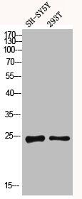 Western blot analysis of SH-SY5Y 293T using Dectin-2 antibody. Antibody was diluted at 1:1000. Secondary antibody  was diluted at 1:20000Rabbit anti-Human CLEC6A Polyclonal Antibody