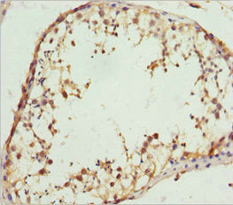 Immunohistochemistry of paraffin-embedded human testis tissue using RACGAP1 Antibody at dilution of 1:100Rabbit anti-Human RACGAP1 Polyclonal Antibody