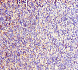 Immunohistochemistry of paraffin-embedded human thymus tissue using RACGAP1 Antibody at dilution of 1:100Rabbit anti-Human RACGAP1 Polyclonal Antibody