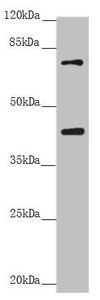 Western blot | All lanes: RACGAP1 antibody at 2.68 μg/ml |  + Raji whole cell lysate | Secondary | Goat polyclonal to rabbit IgG at 1/10000 dilution | Predicted band size: 71 kDa | Observed band size: 71, 40 kDaRabbit anti-Human RACGAP1 Polyclonal Antibody