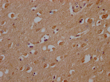 IHC image of OR10A2 Antibody diluted at 1:200 and staining in paraffin-embedded human brain tissue performed on a Leica BondTM system. After dewaxing and hydration, antigen retrieval was mediated by high pressure in a citrate buffer (pH 6.0). Section was blocked with 10% normal goat serum 30min at RT. Then primary antibody (1% BSA) was incubated at 4°C overnight. The primary is detected by a Goat anti-rabbit polymer IgG labeled by HRP and visualized using 0.05% DAB.Rabbit anti-Human OR10A2 Polyclonal Antibody