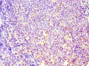 Immunohistochemistry of paraffin-embedded human tonsil tissue using GBA3 Antibody at dilution of 1:100Rabbit anti-Human GBA3 Polyclonal Antibody