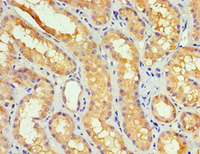 Immunohistochemistry of paraffin-embedded human kidney tissue using GBA3 Antibody at dilution of 1:100Rabbit anti-Human GBA3 Polyclonal Antibody